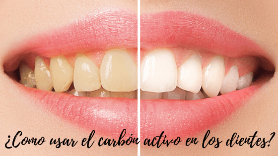 Como usar carbón activo en los dientes: ¿Si blanquea?