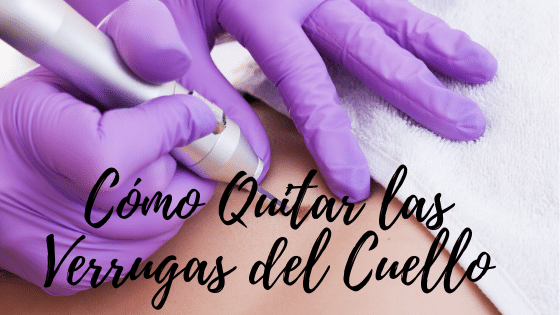 Como Quitar las Verrugas del Cuello: Mucho Cuidado con el Diagnostico
