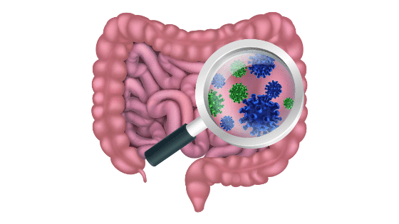 Cómo Eliminar la Candidiasis Intestinal