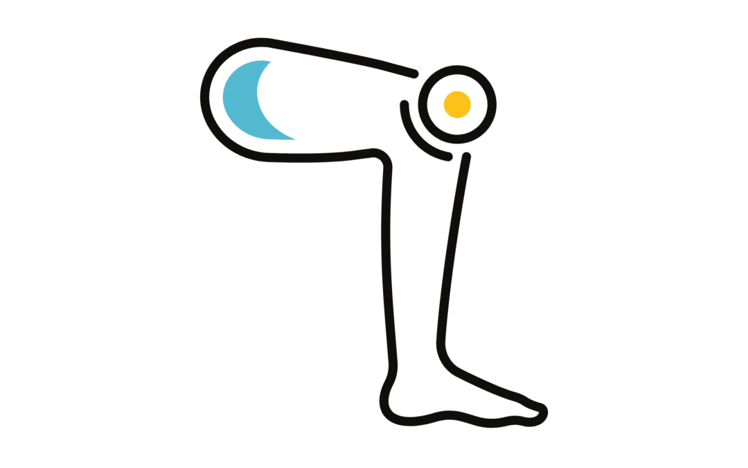 Cómo Curar la Artrosis de Rodilla: Diferentes Métodos