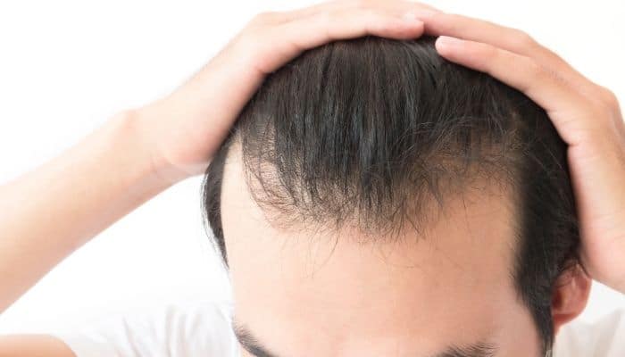 tratamiento para la caida del pelo